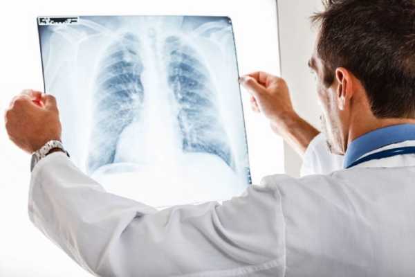 Καρκίνος πνεύμονα: Ο προσυμπτωματικός έλεγχος δεν πραγματοποιείται σε ικανοποιητικά επίπεδα